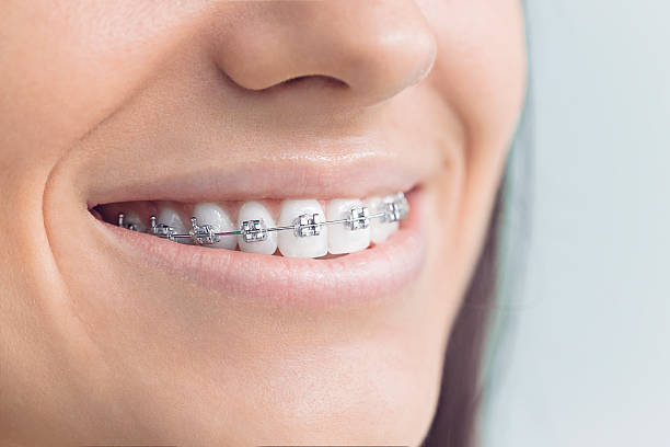Best Traditional Braces  in Nixon, PA